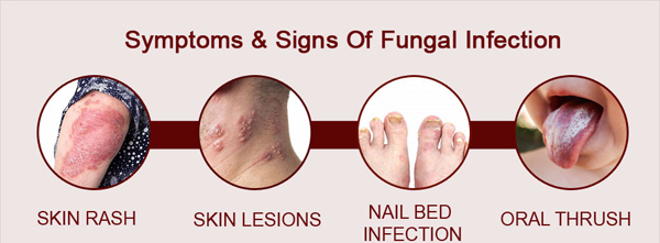 How Turmeric Can Help Fight Fungal Infections